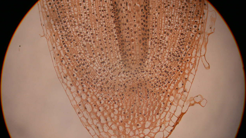 Onion root tip Onion root tip